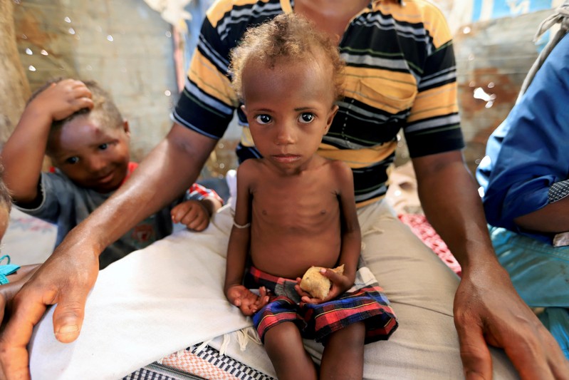 FILE PHOTO: Hanaa Ahmad Ali Bahr, a malnourished girl, sits on her father's lap in a shanty town in Hodeidah, Yemen