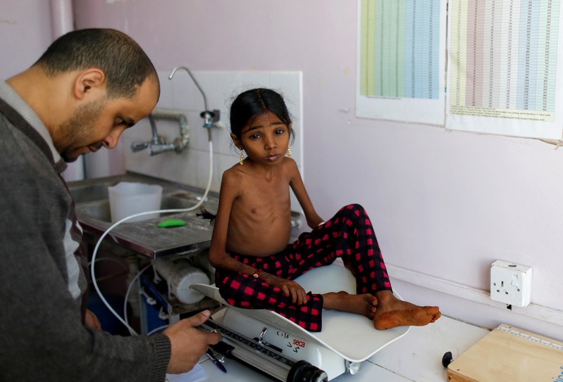 The Wider Image: Hunger stalks Yemen's remote villages after four years of war